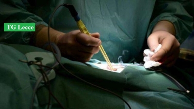 Chirurgia Toracica, interventi chirurgici ad alta tecnologia in diretta dal “Fazzi”